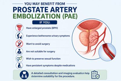 Prostate artery embolization procedure
Enlarged prostate treatment in Lucknow
PAE treatment by Dr. V