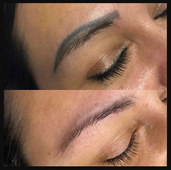 pigment removal, saline removal, li-ft, remove powder brows , bad brow tattoo