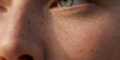 Close-up of a person's eye and nose showing skin texture and freckles.
