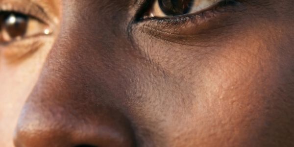 Close-up of a person's eyes and nose showing detailed skin texture.