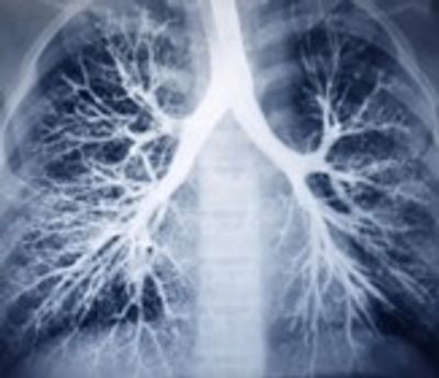 Pulmonary Function Test or Spirometry Test