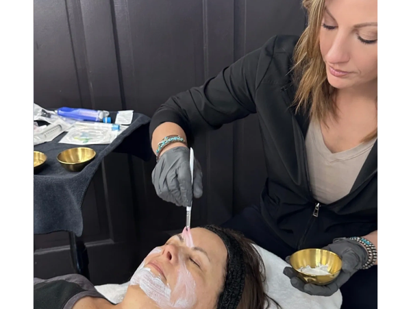 skinpen medical facial treatment by registered nurse at peak aesthetics midvale idaho