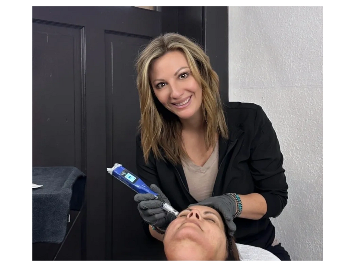 Skinpen Medical Facial provided by Registered nurse at peak aesthetics midvale idaho