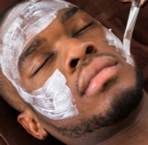 Client showing improved skin clarity and reduced blemishes after receiving a Lactic Acid Peel.