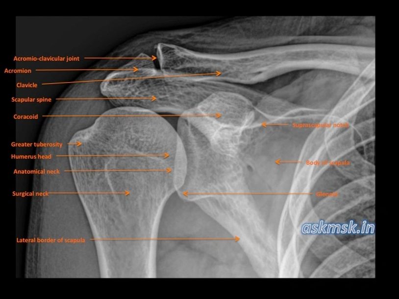 Shoulder Xray anatomy labelled. Humerus glenoid calvicle acromion coracoid