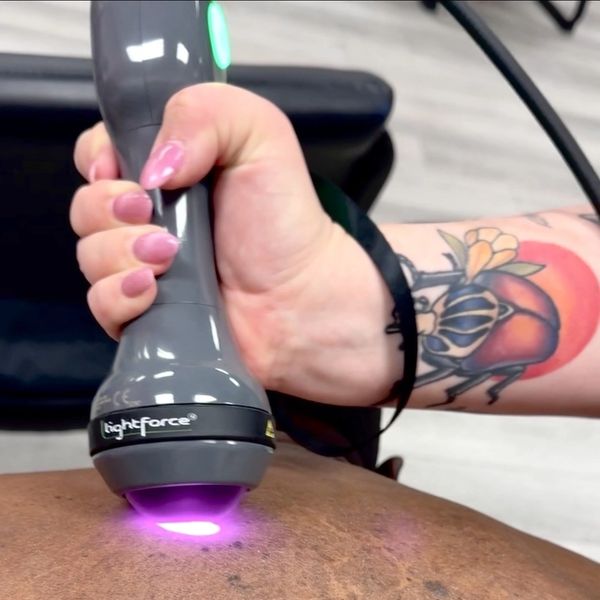 Hand holding LightForce laser device on skin.