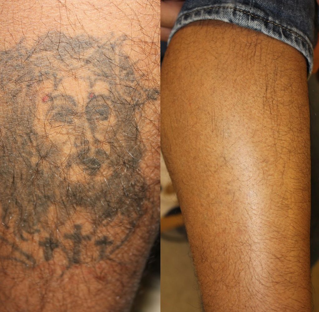 A hispanic dark complected male with a large tattoo on his thigh of Jesus. the second photograph has