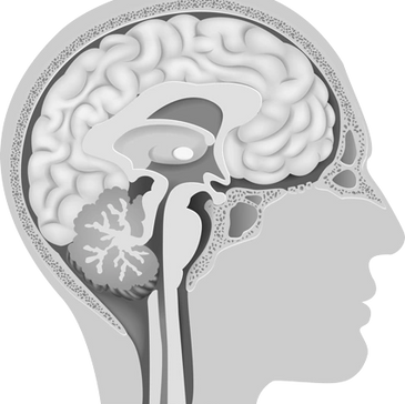 Advance Brain Technologies The Listening Program Brain Image