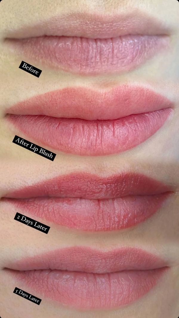 Natural Lip Blush healing barrie