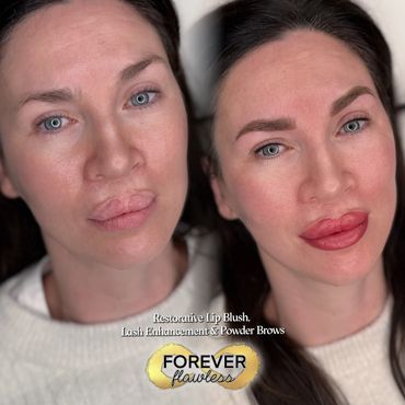 Restorative Lip blush Transformation barrie ontario canada