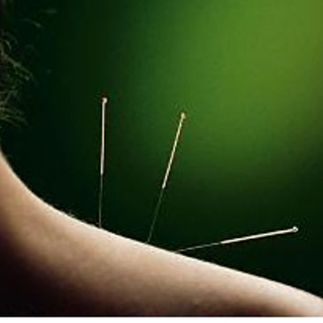 #acupuncture #therapy