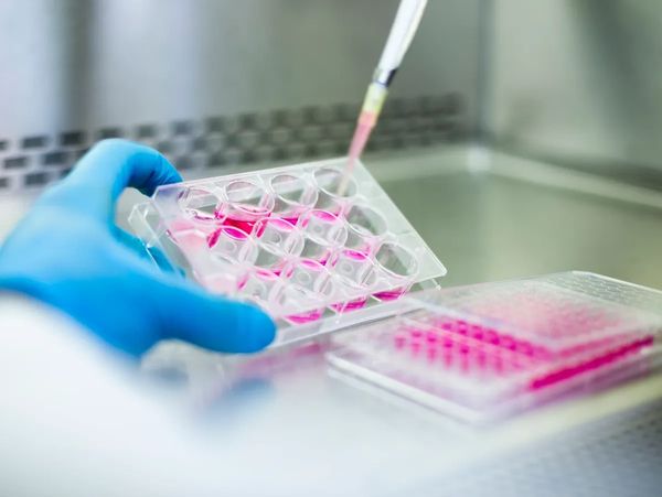 Scientist using pipette to transfer pink liquid in a multi-well plate.