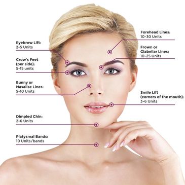 Locations for botox, dysport or xeomin injections to smoothen lines and/or wrinkles on the skin.