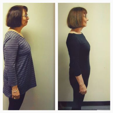 Weight Loss, Healthy Meal Plan, Ideal Weight Loss, Nutritionist, Dietitian, Ideal Protein