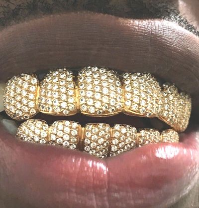 Yellow Gold Mouth Grillz with Diamonds