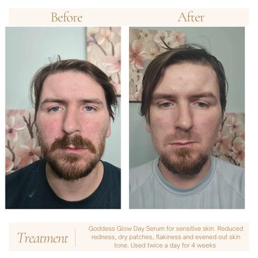 Goddess Glow Day Serum for sensitive skin/ Rosacea