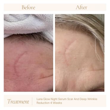 Luna Glow Night Serum