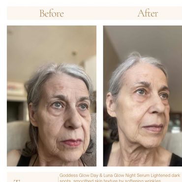 Day & Night Serum/ Softening lines and dark spots