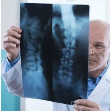 Doctors examining patient's spinal X-ray.