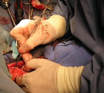 Orthopedic surgery at Alpine Veterinary Service.  Animal doctor performs an orthopedic surgery to repair a fracture at Alpine Veterinary Service.