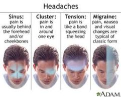 Migraine, Tension, and cluster Headaches