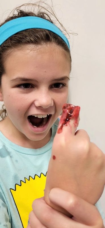 A girl holding her injured finger with blood, looking surprised.