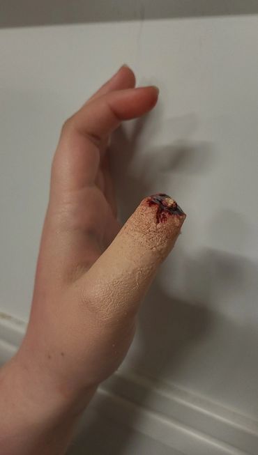 A bandaged finger with a bloody wound at the tip.
