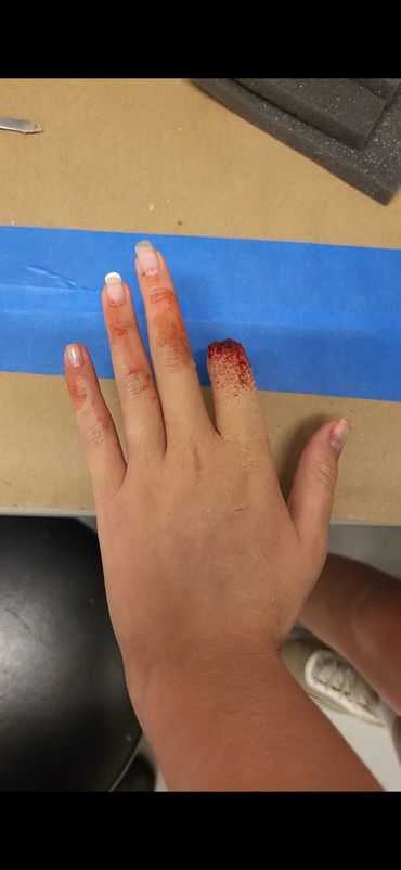 A hand with a bloody injured finger on a table with blue tape.