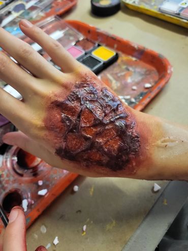A hand with realistic special effects makeup simulating a severe burn wound.