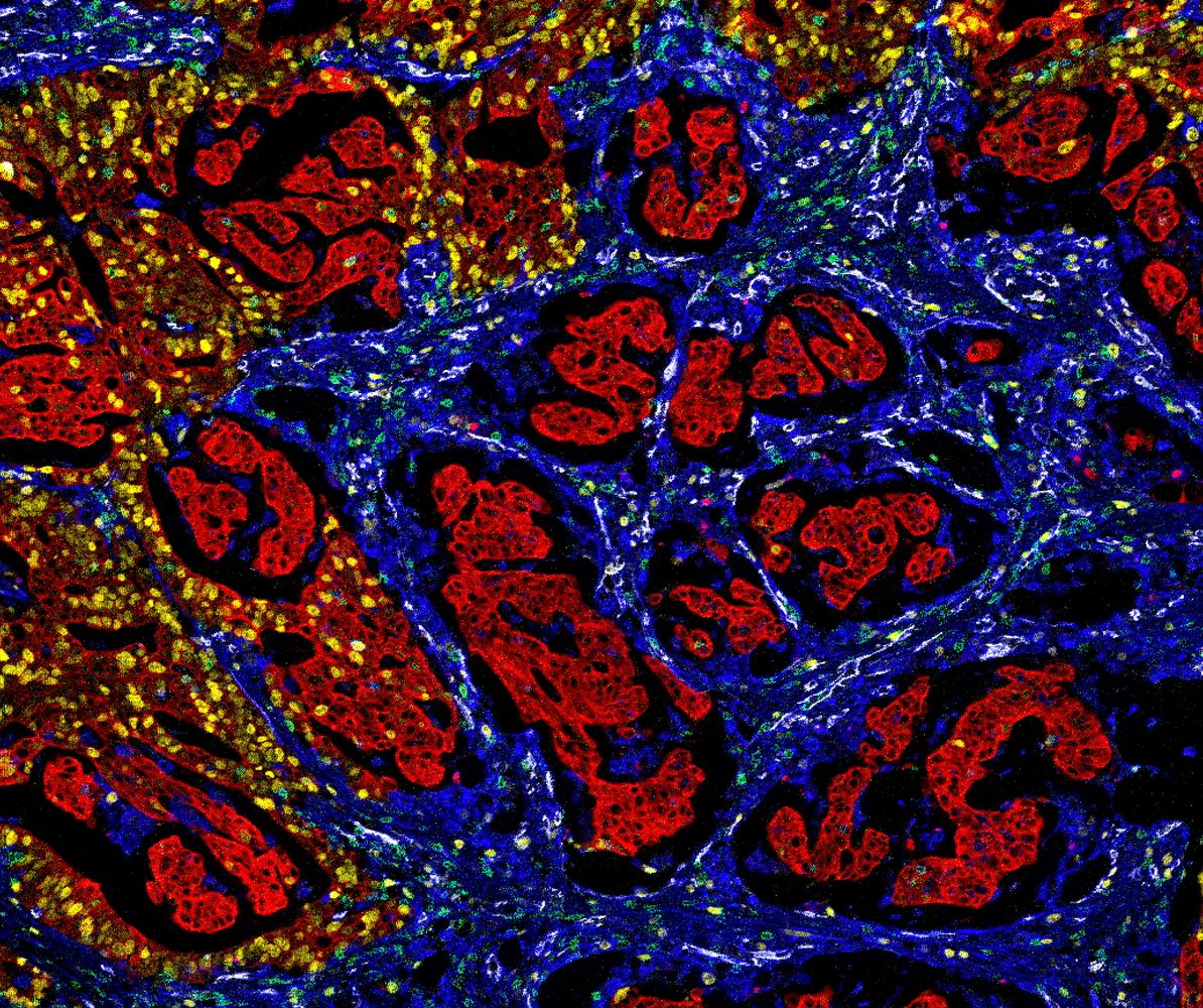 multiplex IHC service CRO