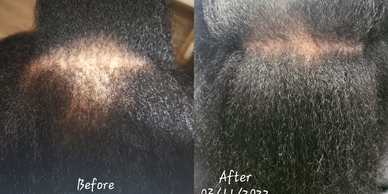 Before & after hair growth of a client participating in Chantal's hair loss treatment program.