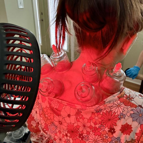 Person receiving red light cupping therapy on their back.