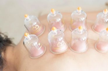 Plastic cups used for cupping therapy on a person's back.