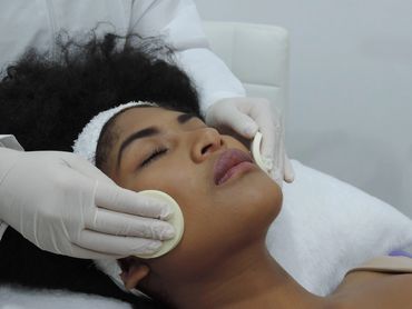 Woman receiving a facial treatment with cotton pads.