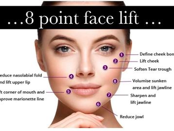 The 8 point facelift involves injecting of dermal filler.