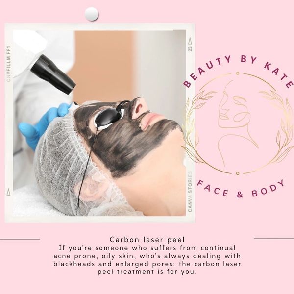 Carbon Laser Peel