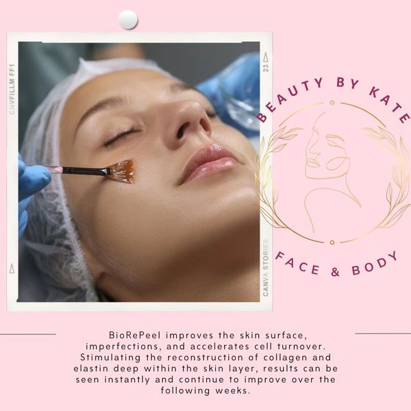 Retinol Peel Treatment