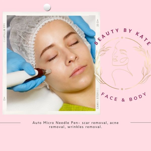 Microneedling Treatment