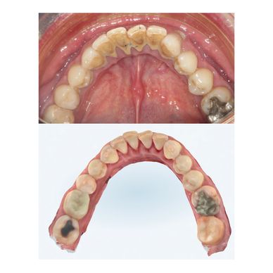 Limpieza dental, detartraje, ortodoncia, diseño digital de sonrisa, invisaling, brackest invisibles