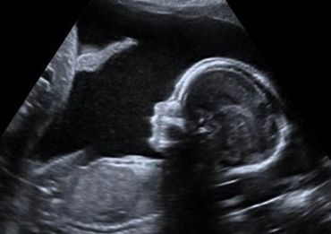 2nd trimester