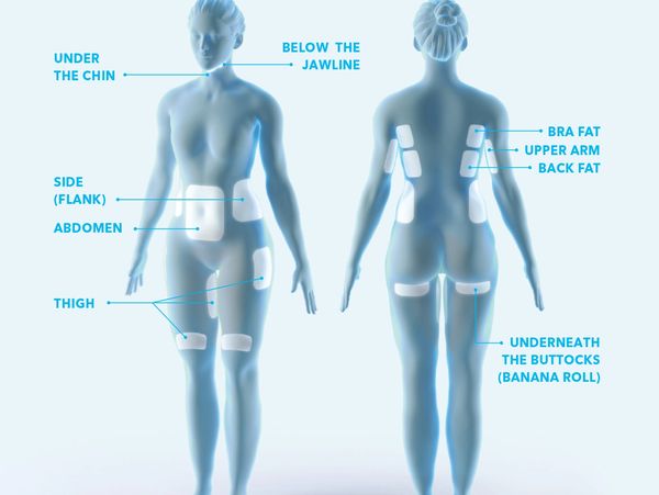 Victoria Botox Clinic, by Dr. Ward. Botox, Juvederm Fillers, CoolSculpting, SkinMedica, Skinvive.