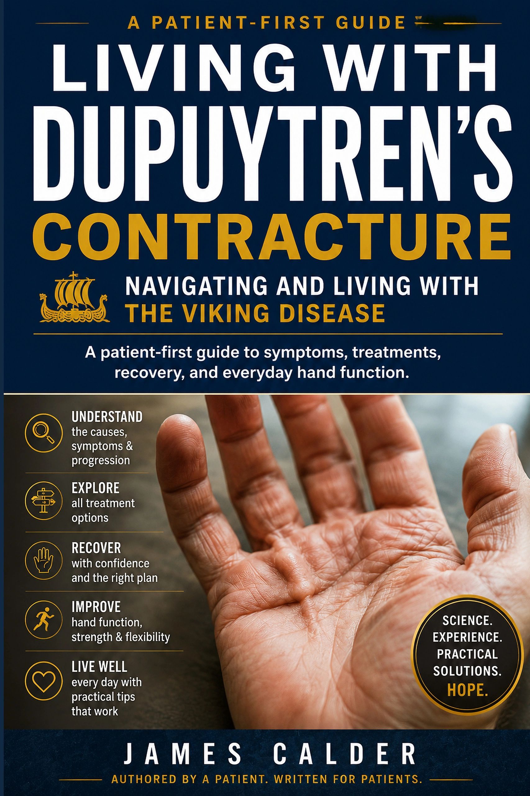Dupuytren’s contracture guidebook cover featuring an open hand and information about symptoms, treatment options and recovery.