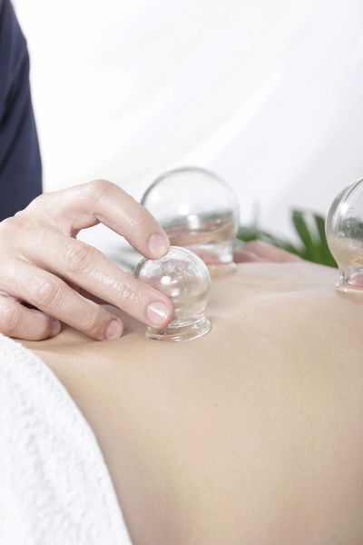 Cupping is one of the many beneficial therapies offered at Los Gatos Acupuncture.