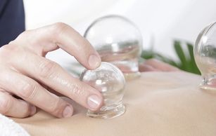 cupping therapy, Chinese medicine, cupping, vacuum cupping