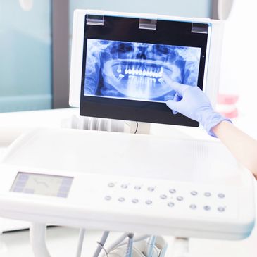 Oral digital x-ray image on computer screen in operatory