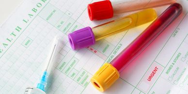 blood and urine test tubes. laboratory and in house testing