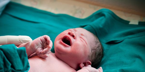 A baby born following Caesarean Delivery