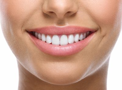 patient smiling for a after teeth whitening treatment picture 