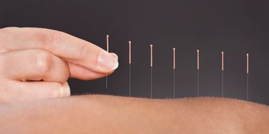 Use acupuncture to restore health and wellness, alleviate pain, insomnia, and anxiety in Park Ridge!