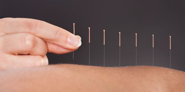 Physiotherapy Clinic in Red Deer, Acupuncture in Red Deer
